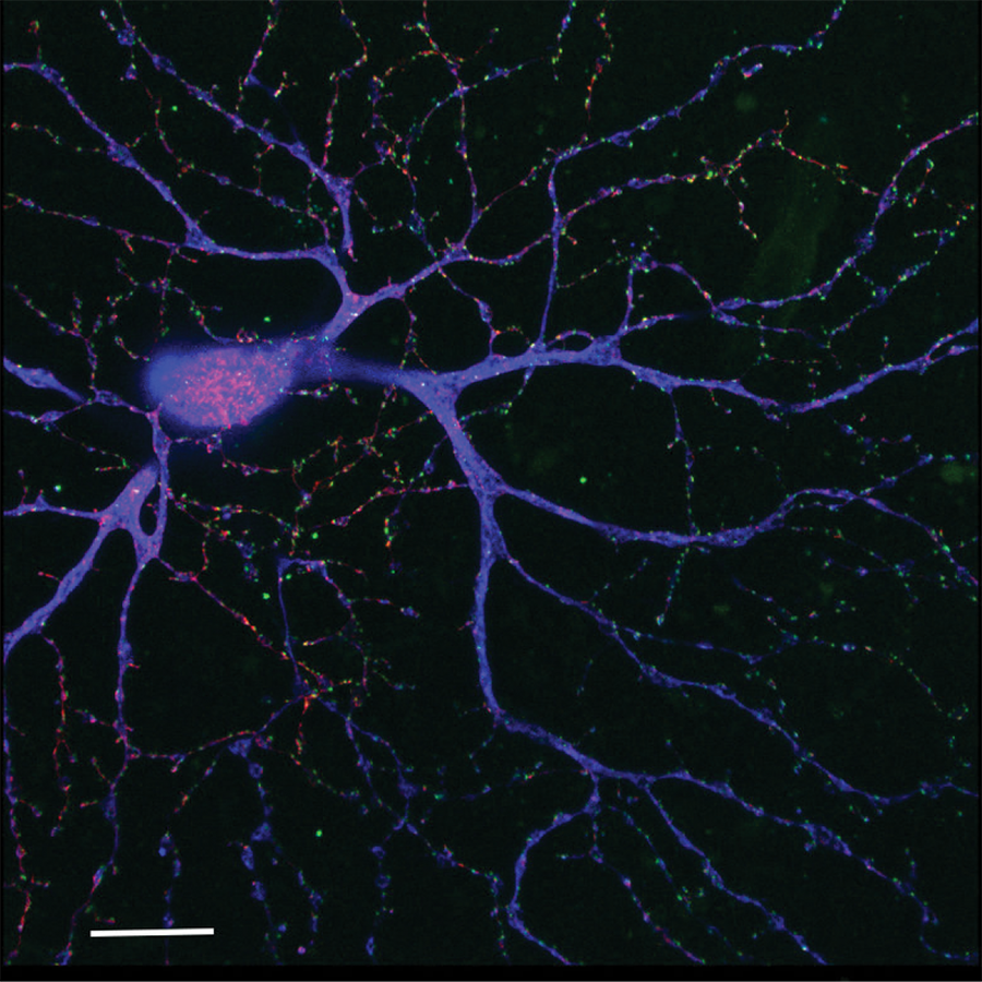 Ganglion Cells: A purple and bright pink retinal ganglion cell against a black background